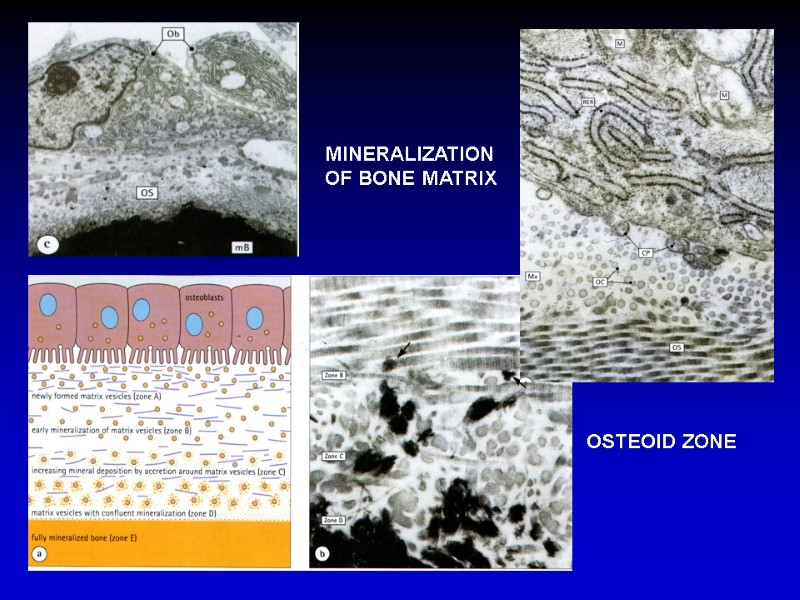 MINERALIZATION OF BONE MATRIX OSTEOID ZONE